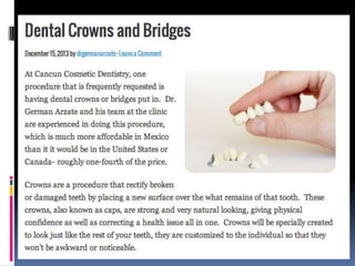 Dental Crowns and Bridges by Dr. German Arzate
