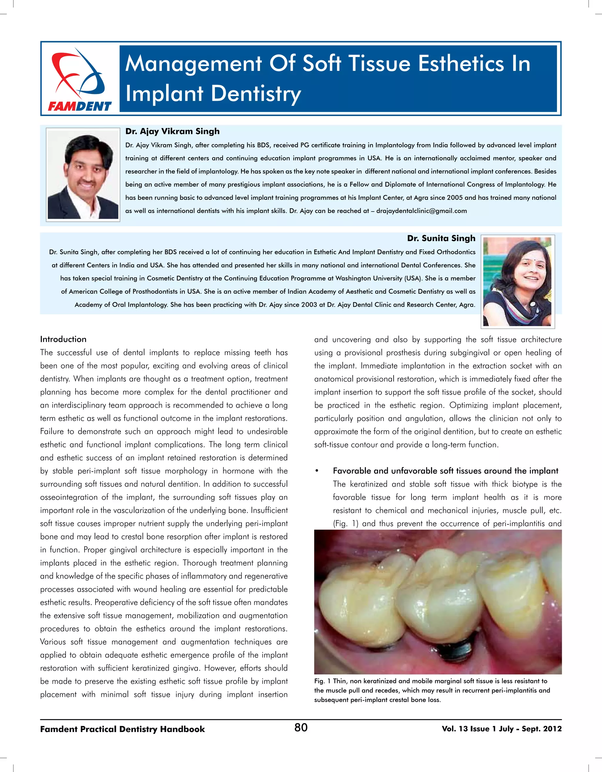 Management of soft tissue aesthetics in implant- D | PDF