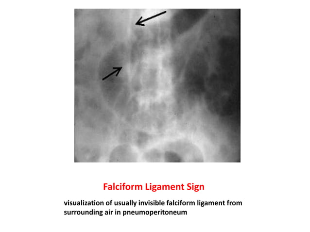 Dr.laith notes about common radiological signs | PPTX