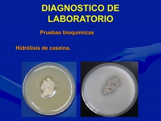 Pruebas bioquímicas
• Hidrólisis de caseina.
DIAGNOSTICO DE
LABORATORIO
 