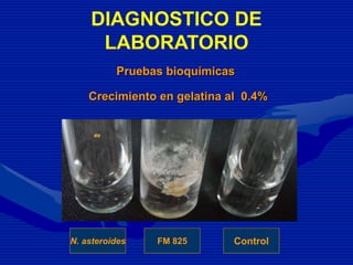 Crecimiento en gelatina al 0.4%
FM 825N. asteroides Control
Pruebas bioquímicas
DIAGNOSTICO DE
LABORATORIO
 