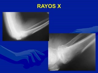 RAYOS X
 