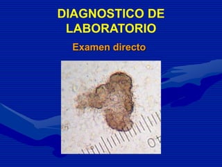Examen directo
DIAGNOSTICO DE
LABORATORIO
 