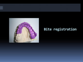 Bite registrationBite registration
 