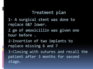 Treatment plan
1- A surgical stent was done to
replace 6&7 lower.
2 gm of amoxicillin was given one
hour before .hour before .
2-Insertion of two implants to
replace missing 6 and 7
3-Closing with sutures and recall the
patient after 3 months for second
stage.
 