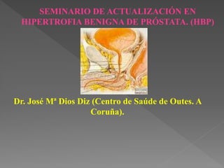 SEMINARIO DE ACTUALIZACIÓN EN
HIPERTROFIA BENIGNA DE PRÓSTATA. (HBP)
Dr. José Mª Dios Diz (Centro de Saúde de Outes. A
Coruña).
 