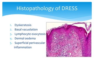 1. Dyskeratosis
2. Basal vacuolation
3. Lymphocyte exocytosis
4. Dermal oedema
5. Superficial perivascular
inflammation
Histopathology of DRESS
 