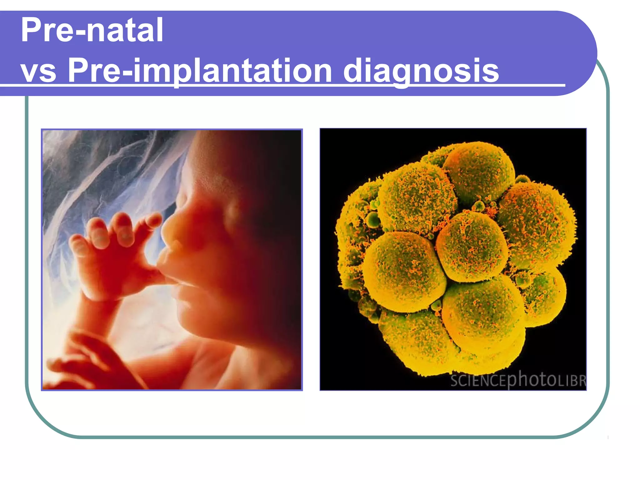 Pre-natal
vs Pre-implantation diagnosis