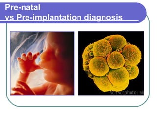Pre-natal 
vs Pre-implantation diagnosis 
 
