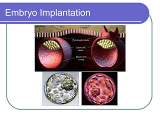 Embryo Implantation 
 