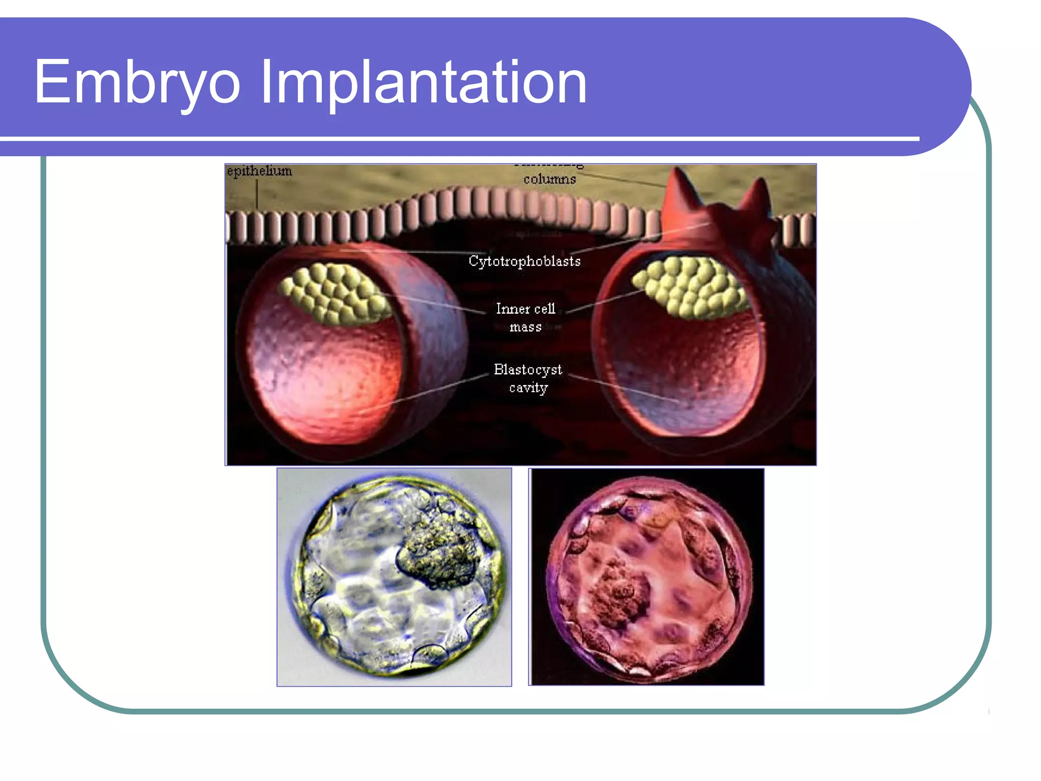 Embryo Implantation
