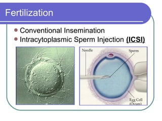 Fertilization
Conventional Insemination
Intracytoplasmic Sperm Injection (ICSI)