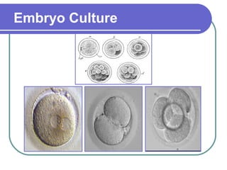 Embryo Culture