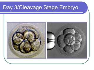 Day 3/Cleavage Stage Embryo