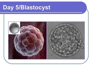 Day 5/Blastocyst