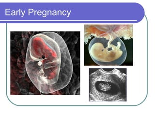 Early Pregnancy