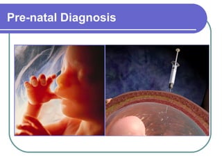 Pre-natal Diagnosis