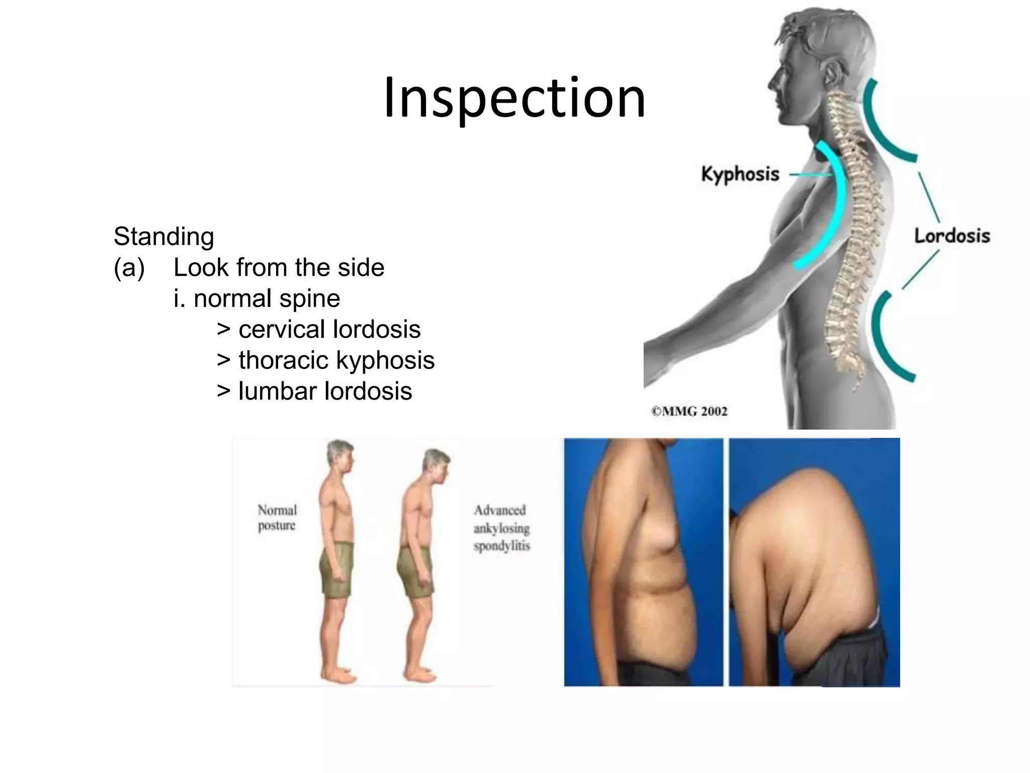 Inspect Spinal Alignment spine examination by Dr.guru prasad | PPTX