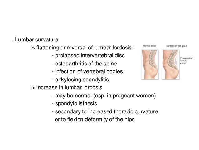 Sacral Dimple In Women