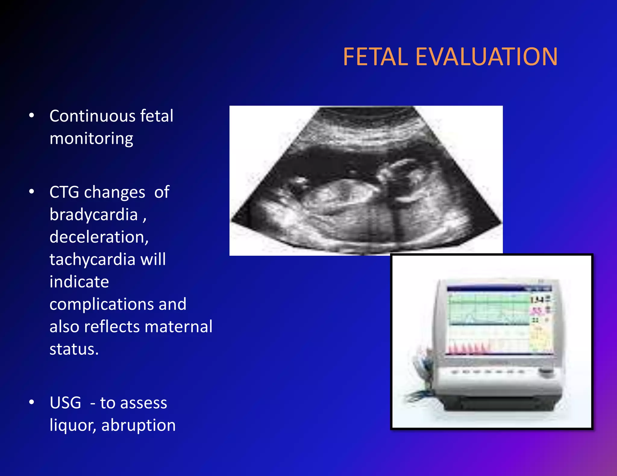 FETAL EVALUATION 
• Continuous fetal 
monitoring 
• CTG changes of 
bradycardia , 
deceleration, 
tachycardia will 
indicate 
complications and 
also reflects maternal 
status. 
• USG - to assess 
liquor, abruption 
 