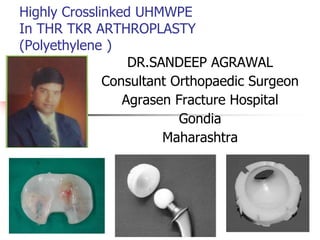 Highly Crosslinked UHMWPE 
In THR TKR ARTHROPLASTY 
(Polyethylene ) 
DR.SANDEEP AGRAWAL 
Consultant Orthopaedic Surgeon 
Agrasen Fracture Hospital 
Gondia 
Maharashtra 
 