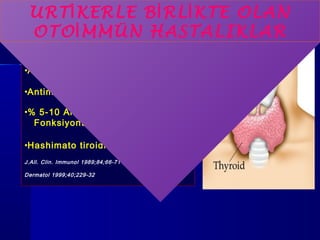 URT İKERLE BİRLİKTE OLAN 
OTOİMMÜN HASTALIKLAR 
•Antithyroglobulin Ab %8, 
•Antimikrosomal Ab %5, 
•% 5-10 Artmış/ azalmış tiroid 
Fonksiyonu , 
•Hashimato tiroiditi. 
J.All. Clin. Immunol 1989;84;66-71 
Dermatol 1999;40;229-32 
 