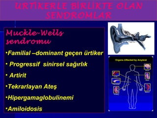 URT İKERLE BİRLİKTE OLAN 
SENDROMLAR 
Muckle-Wells 
sendromu 
•Familial –dominant geçen ürtiker 
• Progressif sinirsel sağırlık 
• Artirit 
•Tekrarlayan Ateş 
•Hipergamaglobulinemi 
•Amiloidosis 
 