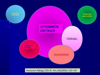 ÜRTİKERYAL 
VASKÜLİT 
OTOİMMÜN 
ÜRTİKER 
KONTAKT 
ÜRTİKER 
FİZİKSEL 
Ürtikeryal 
sendromlar 
ANJİOODEM 
Immunol Allergy.Clin.N. Am.24(2004);103-181 
 