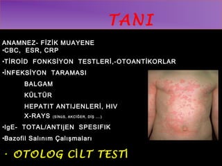 TANI 
ANAMNEZ- FİZİK MUAYENE 
•CBC, ESR, CRP 
•TİROİD FONKSİYON TESTLERİ,-OTOANTİKORLAR 
•İNFEKSİYON TARAMASI 
BALGAM 
KÜLTÜR 
HEPATIT ANTIJENLERİ, HIV 
X-RAYS (SİNüS, AKCİĞER, DİŞ ….) 
•IgE- TOTAL/ANTIjEN SPESIFIK 
•Bazofil Salınım Çalışmaları 
• OTOLOG CİLT TESTİ 
 