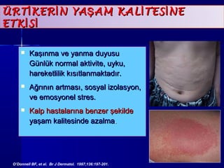 ÜÜRRTTİİKKEERRİİNN YYAAŞŞAAMM KKAALLİİTTEESSİİNNEE 
EETTKKİİSSİİ 
 KKaaşşıınnmmaa vvee yyaannmmaa dduuyyuussuu 
GGüünnllüükk nnoorrmmaall aakkttiivviittee,, uuyykkuu,, 
hhaarreekkeettlliilliikk kkııssııttllaannmmaakkttaaddıırr.. 
 AAğğrrıınnıınn aarrttmmaassıı,, ssoossyyaall iizzoollaassyyoonn,, 
vvee eemmoossyyoonneell ssttrreess.. 
 KKaallpp hhaassttaallaarrıınnaa bbeennzzeerr şşeekkiillddee 
yyaaşşaamm kkaalliitteessiinnddee aazzaallmmaa.. 
O’Donnell BF, et al. Br J Dermatol. 1997;136:197-201. 
 