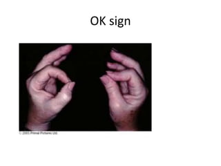 Okay Sign Leg Entrapment syndromes | PPTX