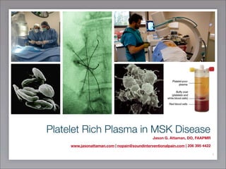 Platelet Rich Plasma in MSK Disease
Jason G. Attaman, DO, FAAPMR
www.jasonattaman.com | nopain@soundinterventionalpain.com | 206 395 4422
1
 