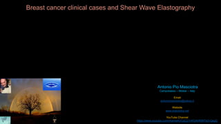 Antonio Pio Masciotra
Campobasso – Molise – Italy
Email
antoniomasciotra@yahoo.it
Website
www.masciotra.net
YouTube Channel
https://www.youtube.com/channel/UCgCj21nKGAhR997Ia3-QegQ
Breast cancer clinical cases and Shear Wave Elastography
 