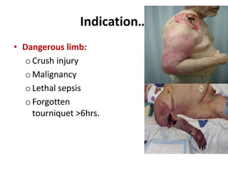 Indication…
• Dangerous limb:
o Crush injury
o Malignancy
o Lethal sepsis
o Forgotten
tourniquet >6hrs.
 
