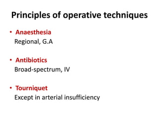 Principles of operative techniques
• Anaesthesia
Regional, G.A
• Antibiotics
Broad-spectrum, IV
• Tourniquet
Except in arterial insufficiency
 
