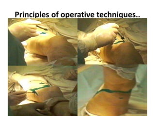 Principles of operative techniques..
 