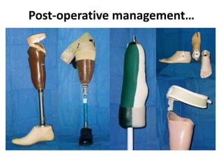 Post-operative management…
 