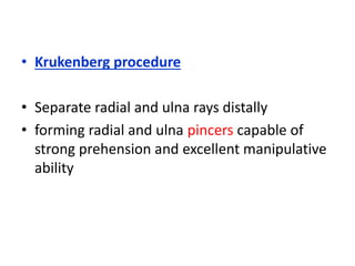 • Krukenberg procedure
• Separate radial and ulna rays distally
• forming radial and ulna pincers capable of
strong prehension and excellent manipulative
ability
 