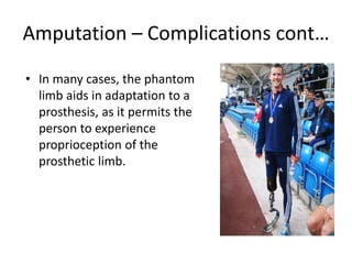 Amputation – Complications cont…
• In many cases, the phantom
limb aids in adaptation to a
prosthesis, as it permits the
person to experience
proprioception of the
prosthetic limb.
 