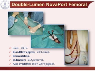  Size: 24 Fr.
 Bloodflow approx. 2.0 L/min.
 Recirculation.
 Indication: CO2 removal.
 Also available: 18 Fr, 22 Fr jugular.
 