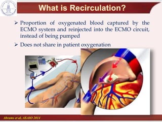 Abrams et al, ASAIO 2014
 Proportion of oxygenated blood captured by the
ECMO system and reinjected into the ECMO circuit,
instead of being pumped
 Does not share in patient oxygenation
 