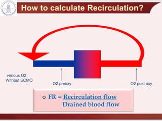 O2 post oxy
venous O2
Without ECMO
O2 preoxy
 FR = Recirculation flow
Drained blood flow
 