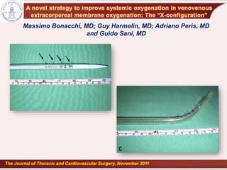 Massimo Bonacchi, MD; Guy Harmelin, MD; Adriano Peris, MD
and Guido Sani, MD
The Journal of Thoracic and Cardiovascular Surgery, November 2011
 