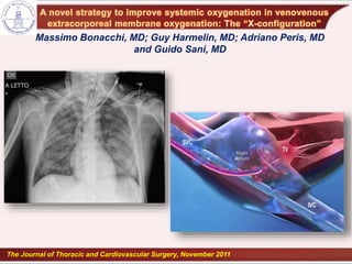 Massimo Bonacchi, MD; Guy Harmelin, MD; Adriano Peris, MD
and Guido Sani, MD
The Journal of Thoracic and Cardiovascular Surgery, November 2011
 