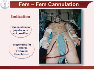 Cannulation in
jugular vein
not possible.
Higher risk for
femoral
vein/caval
thrombosis(?)
 