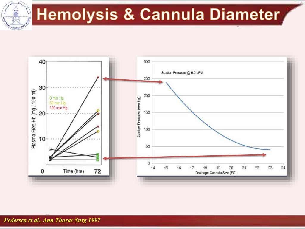 cannulation and recirculation in vv ecmo
