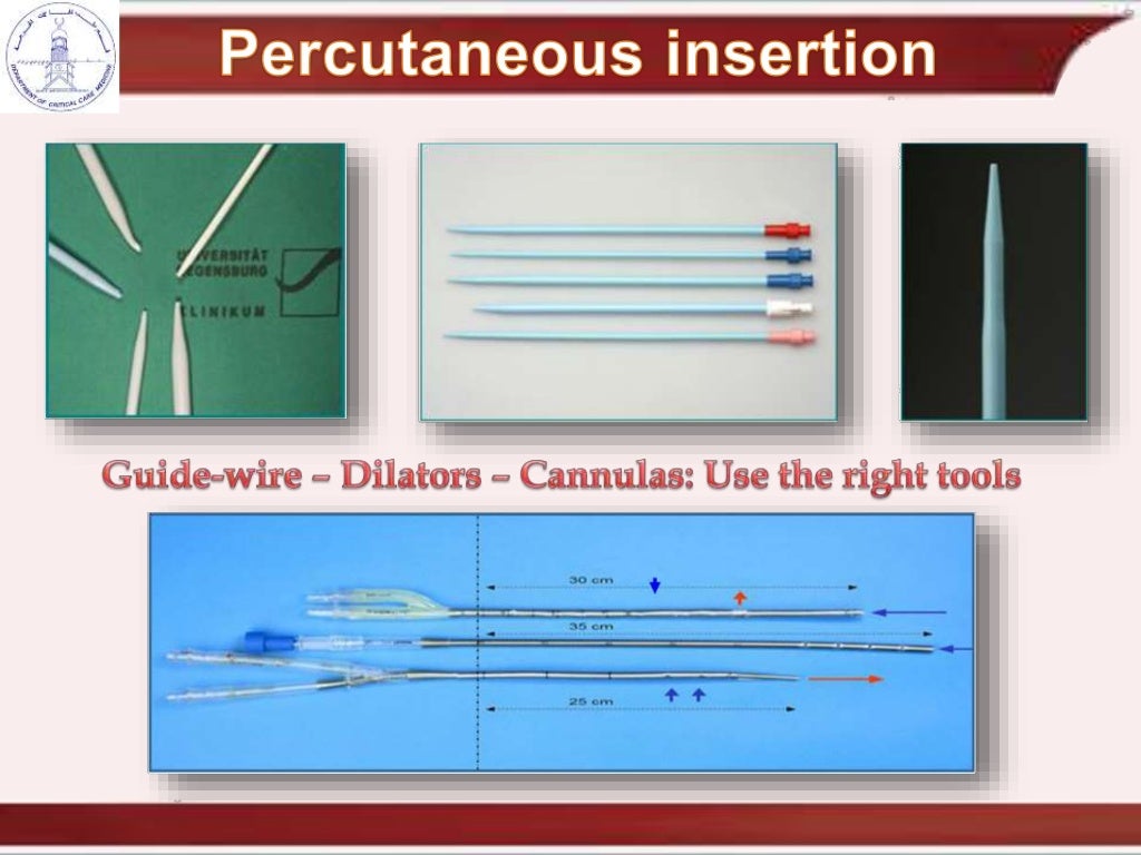 cannulation and recirculation in vv ecmo
