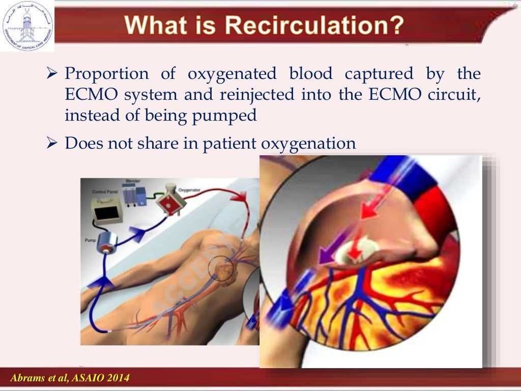 cannulation and recirculation in vv ecmo