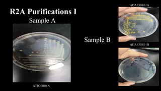 R2A Purifications I
Sample A
Sample B
ADAP30R01A
ADAP30R01B
ATB30R01A
 
