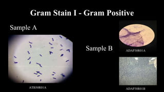 Gram Stain I - Gram Positive
Sample A
Sample B ADAP30R01A
ATB30R01A ADAP30R01B
 